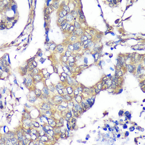 TXNDC9 Polyclonal Antibody
