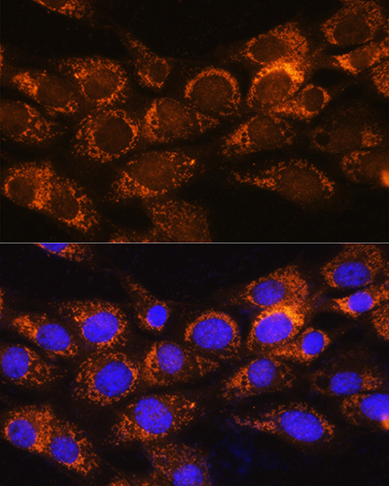 BCKDHA Polyclonal Antibody