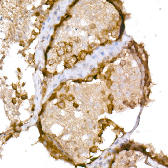 CTAG1B Polyclonal Antibody