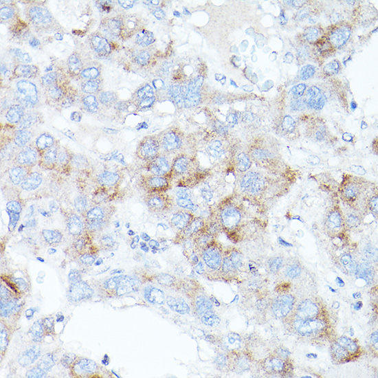 TFR2 Polyclonal Antibody