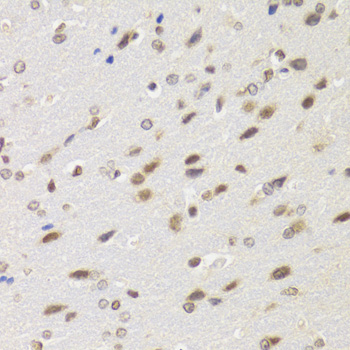 [KO Validated] BAZ1B Polyclonal Antibody