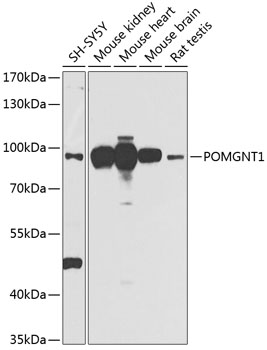 POMGNT1 Polyclonal Antibody