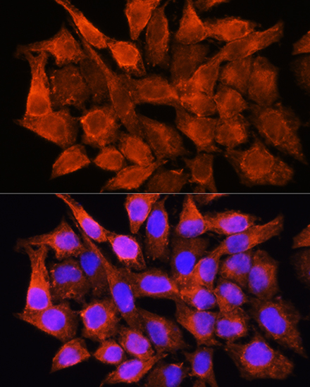 AMT Polyclonal Antibody