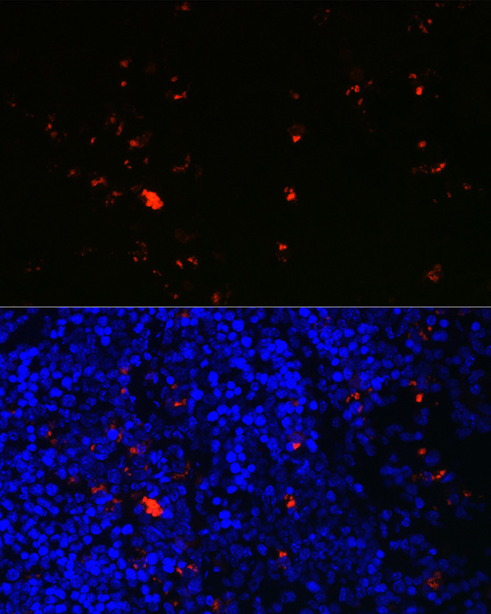 RNASE2 Polyclonal Antibody