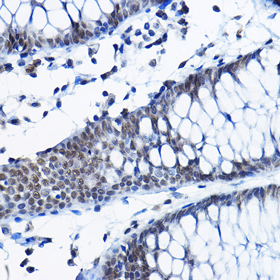 RPP25 Polyclonal Antibody