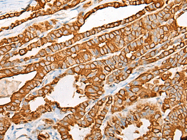ACOT7 antibody