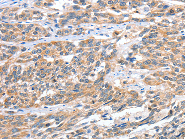 CGB3 antibody