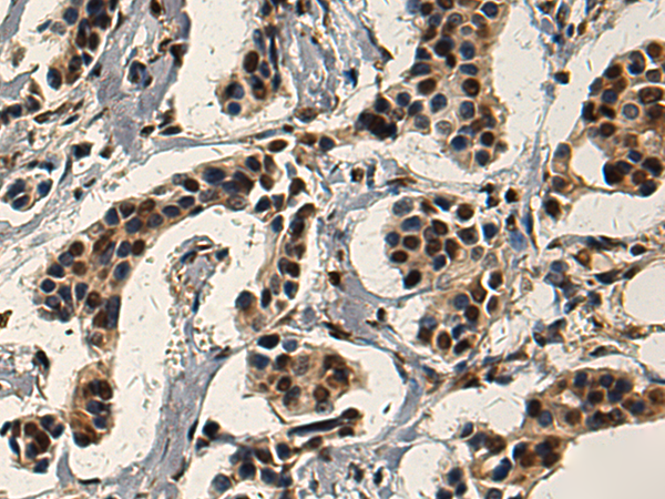 SERTAD3 antibody