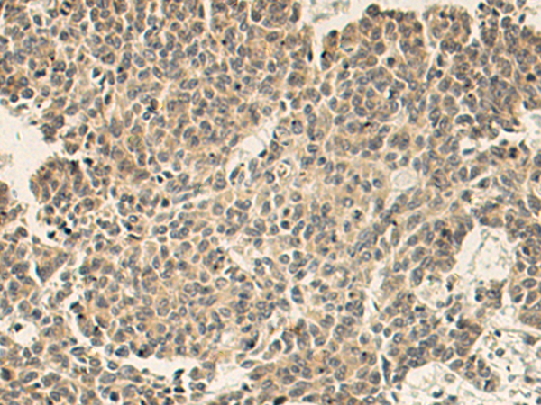 SNAP47 antibody