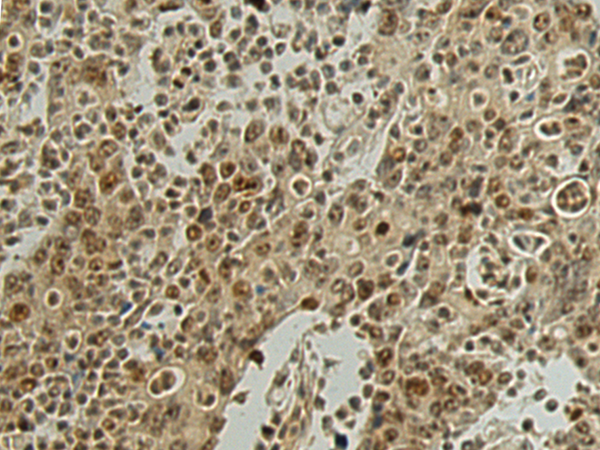 SURF6 antibody