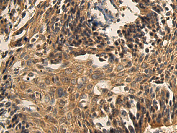 XAGE2 antibody