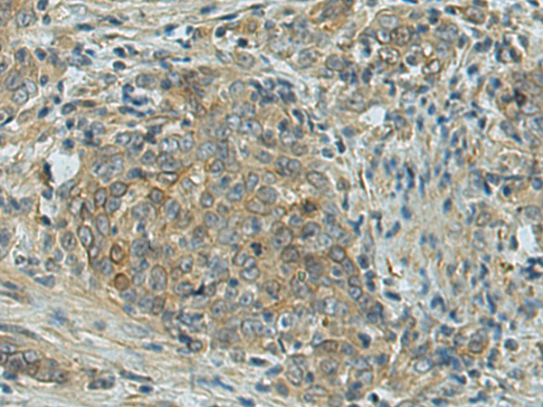 LRRC45 antibody
