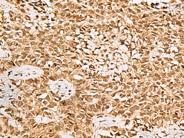 LRRC2 antibody