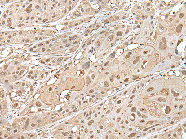 ZNF202 antibody