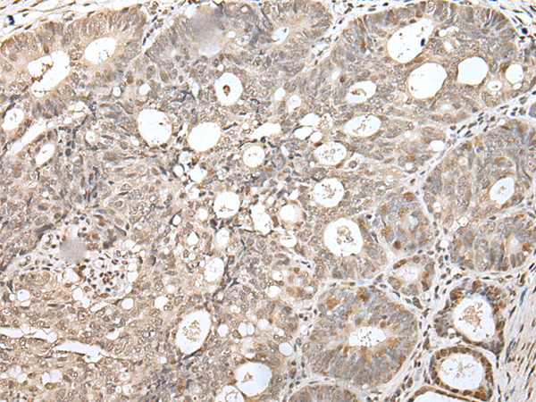 ZNF266 antibody