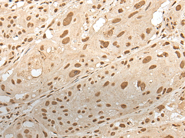 ZNF274 antibody