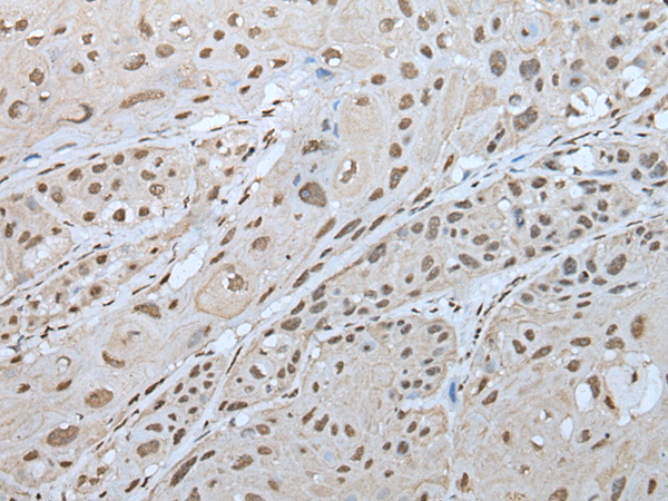 ZNF300 antibody