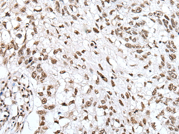 ZNF43 antibody