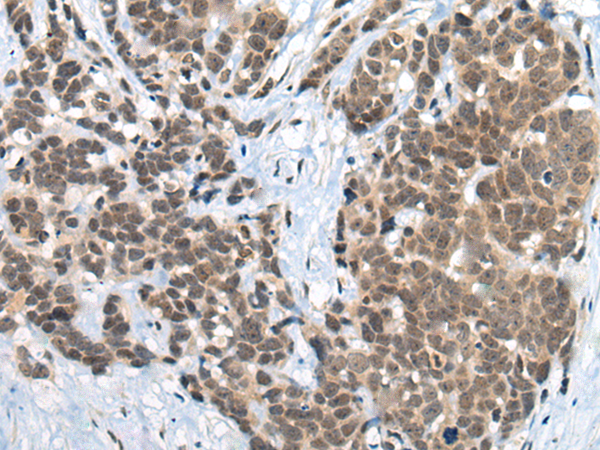 ZNF83 antibody