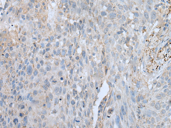 VWA2 antibody