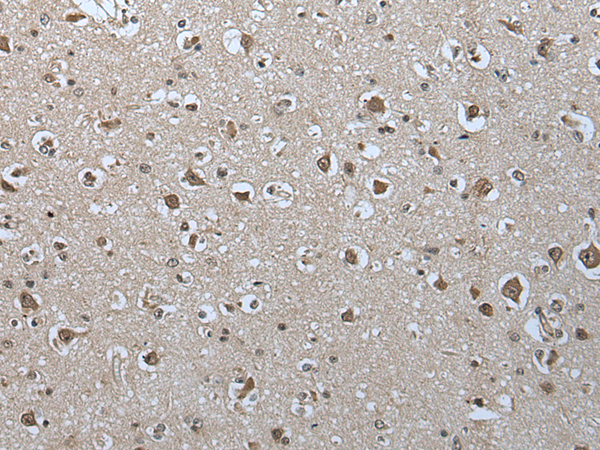 USP35 antibody