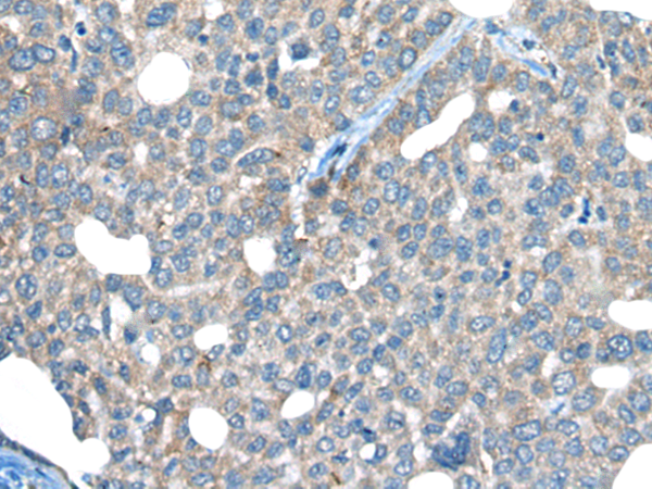 INF2 antibody