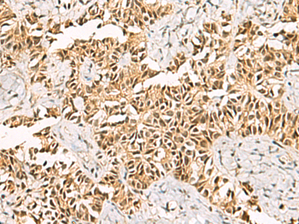 LRIF1 antibody