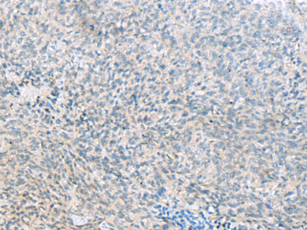 C1orf112 antibody