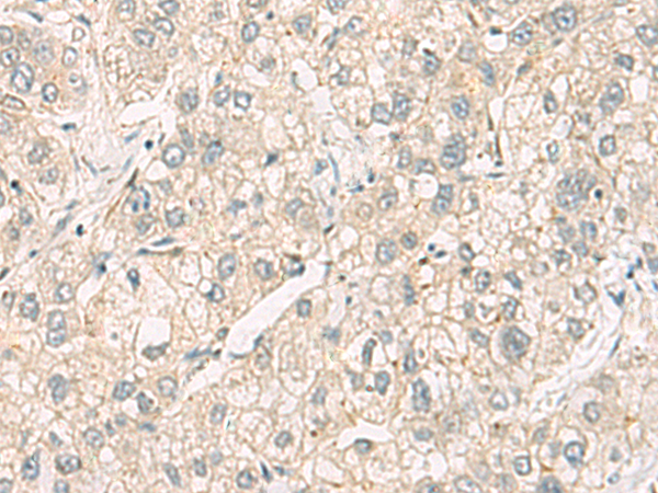 C3orf38 antibody