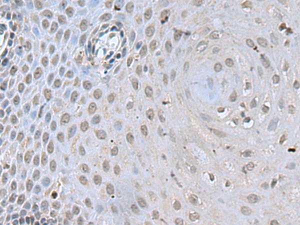 DCPS antibody