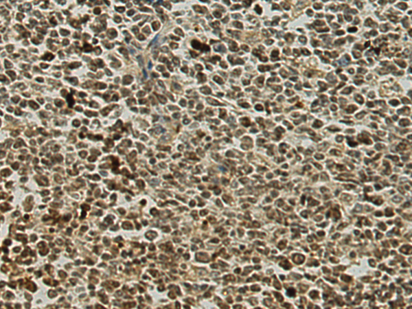 DDX47 antibody