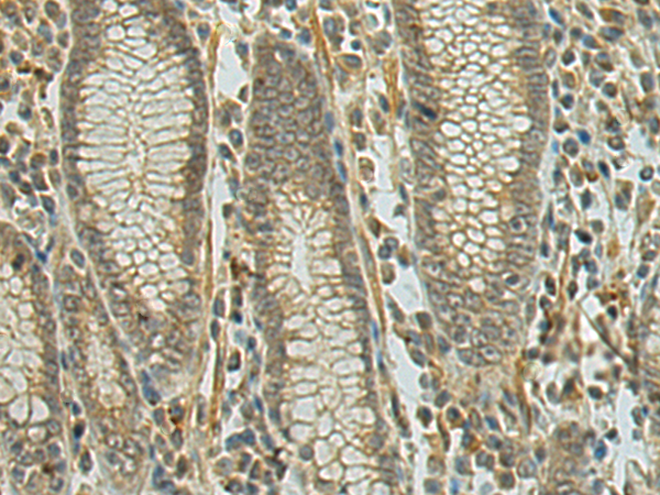 DENND1A antibody