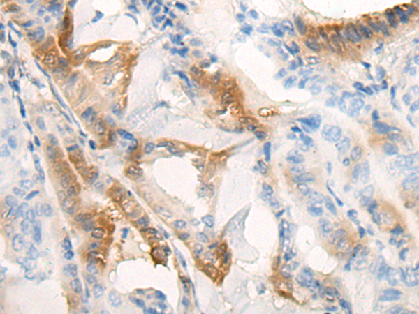 KCTD17 antibody