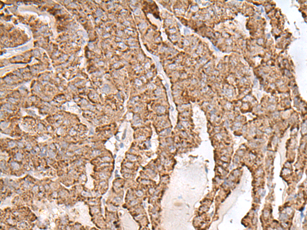 AP1S1 antibody