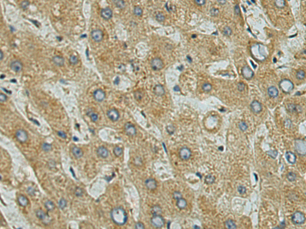 USP53 antibody