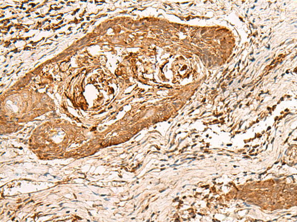 HIRIP3 antibody