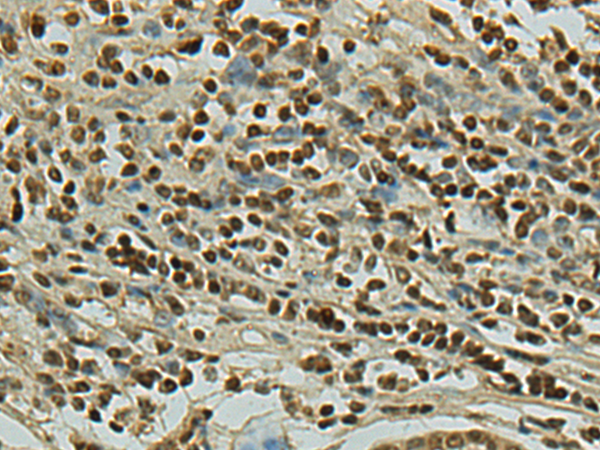 FBH1 antibody
