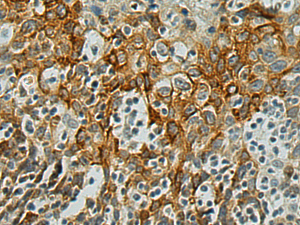 ATP6V0A1 antibody
