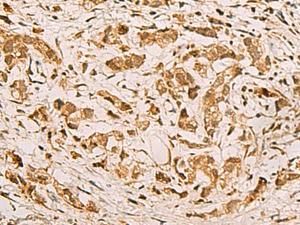 ZMAT4 antibody