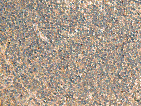 GPBP1 antibody