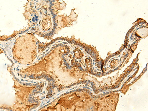KIAA0513 antibody