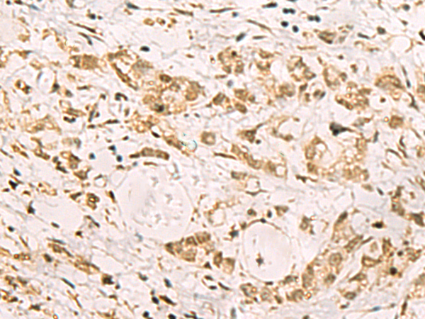 PDS5A antibody