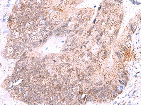 ASTN2 antibody