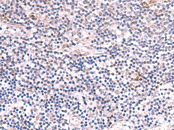 INPP5K antibody