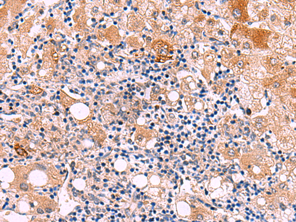 KATNAL1 antibody