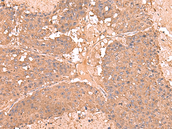 AHCYL1 antibody