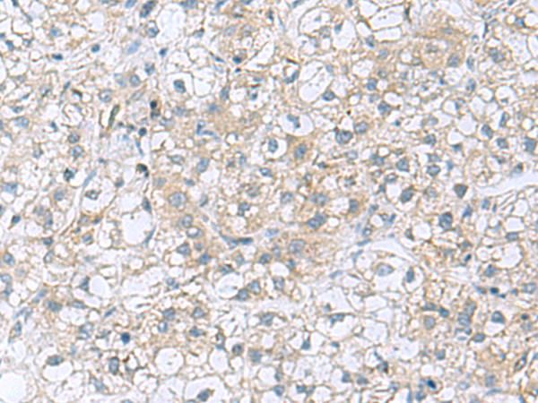 TRO antibody