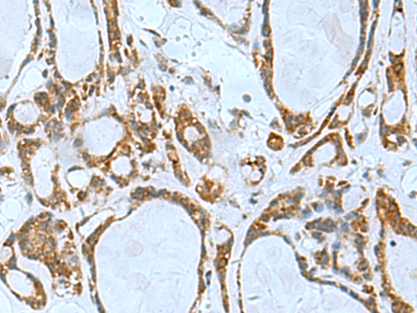 TSGA10 antibody