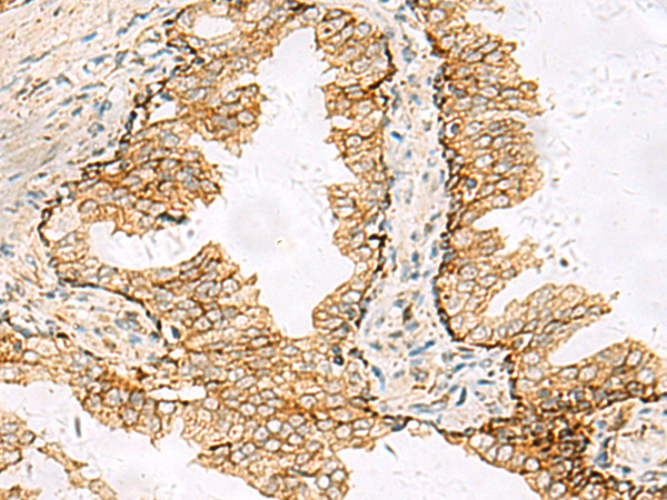 SH3YL1 antibody