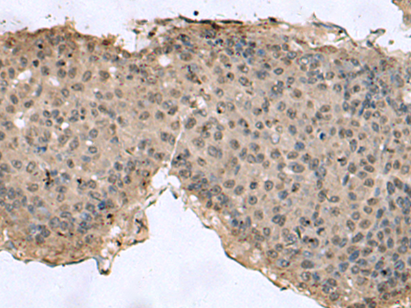 TMX3 antibody